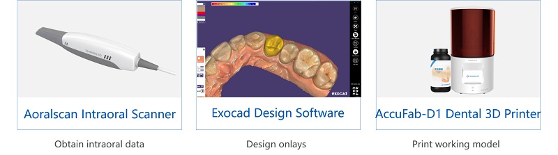 Equipment for AoralScan Chairside Real-time Restoration