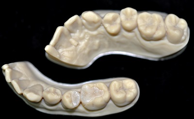 Adjustment, glazing, and try-in for AoralScan Chairside Real-time Restoration