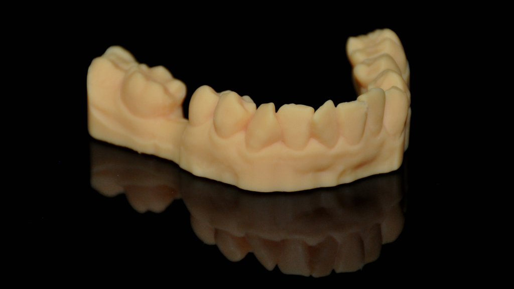 3D printed model for Narrow Diameter Implant in Posterior Mandible surgical guide
