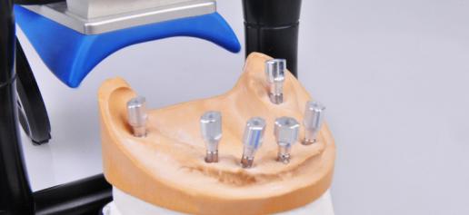 Initial scan for the patient's full edentulous jaw implant restoration