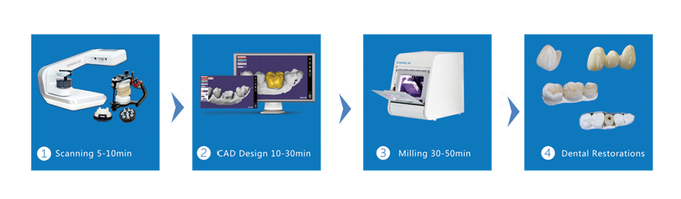 Infographic of chairside restoration with DS-EX Series 3D Scanner process