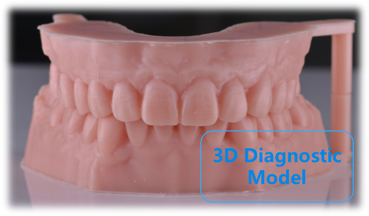 Digital 3D diagnostic model