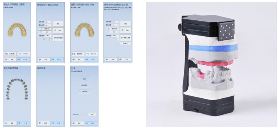 Screenshots from DentalScan software and a photo of the upper and lower jaw models on the special fixture.