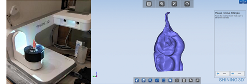 3D scanning the bite data for chairside restoration with DS-EX Series 3D Scanner