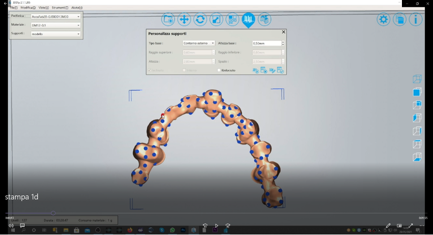 digital wax-up bridge 3D model