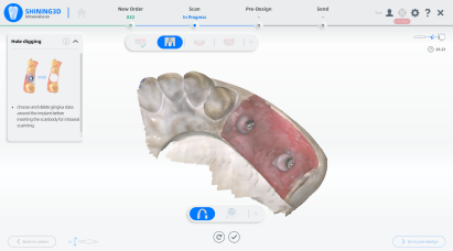 Step-by-step guidance within AoralScan software.