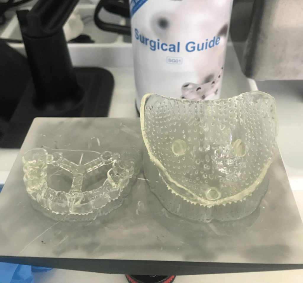 The 3D Printed Full Denture surgical guide