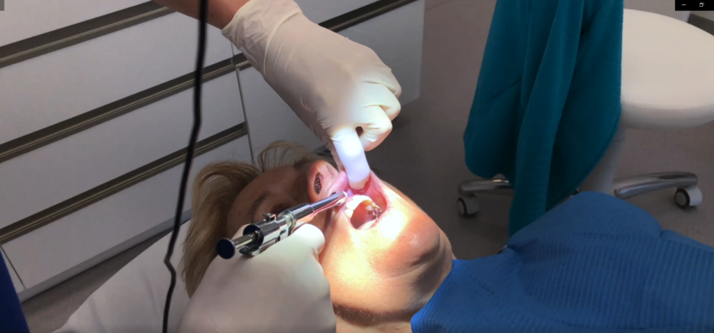 effective dental impression RM case study