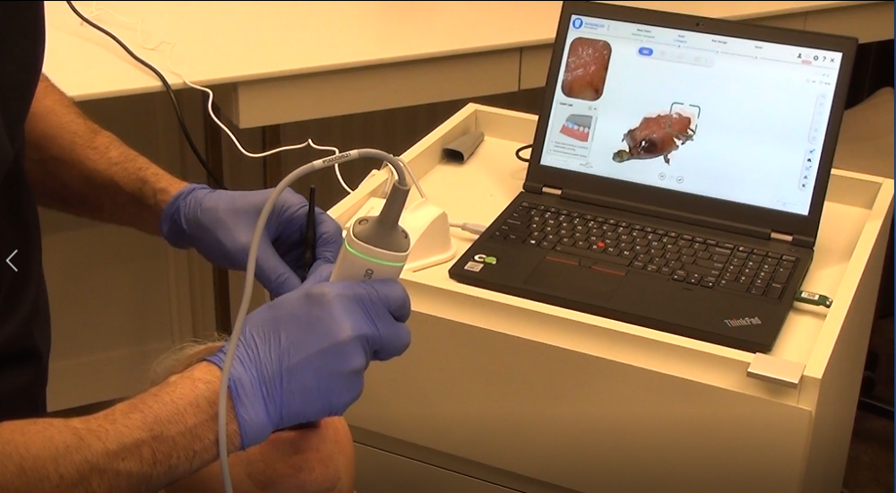 Dental 3D scanning for immediate implants Aoralscan 3