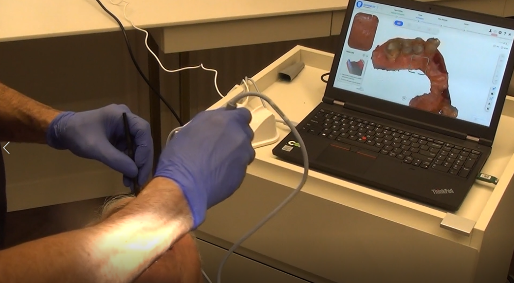 Dental 3D scanning for immediate implants Aoralscan 3