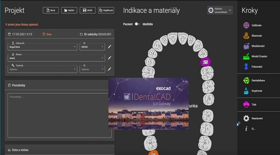 Importing digital dental impression data to exocad
