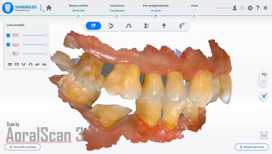 Scan data with Aoralscan 3