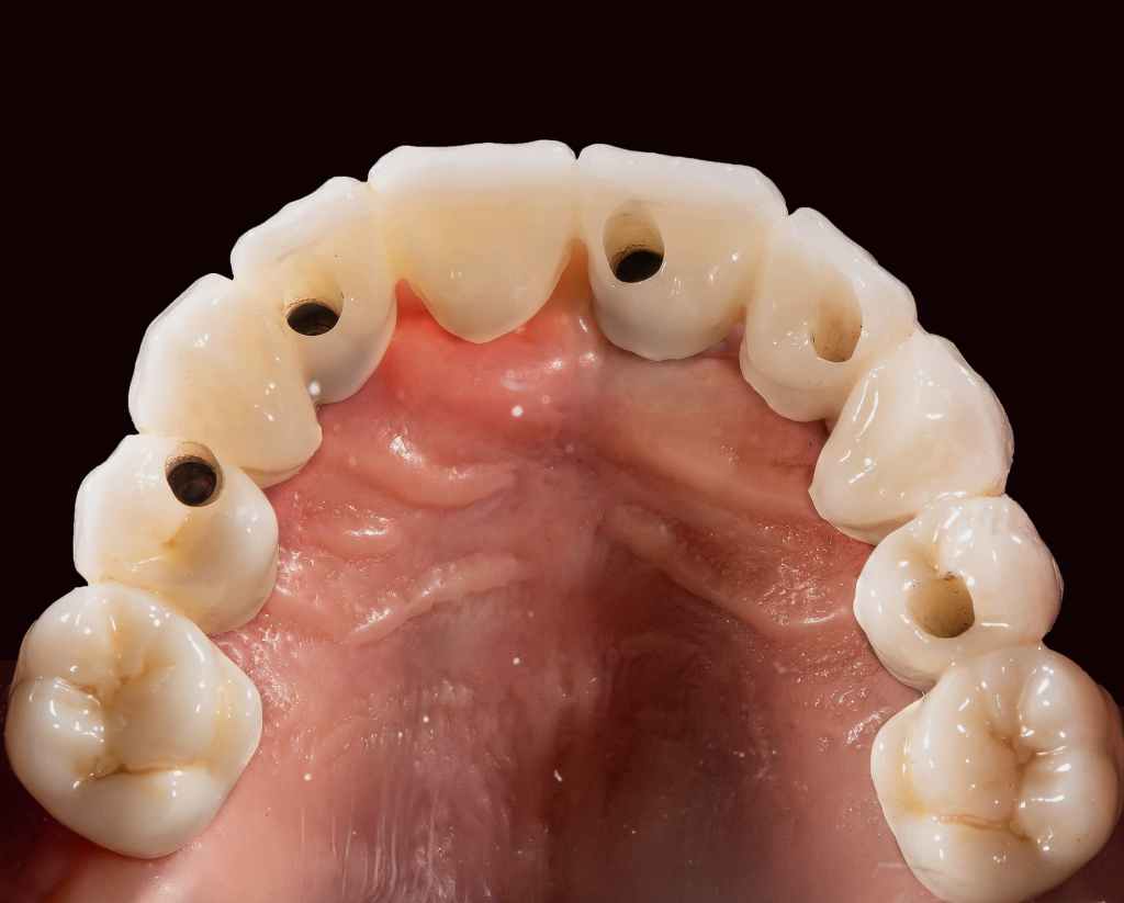 Oral maxillofacial view