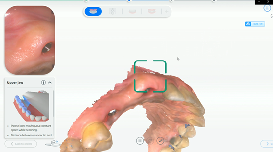 Fig. 2 - Scan without scan body