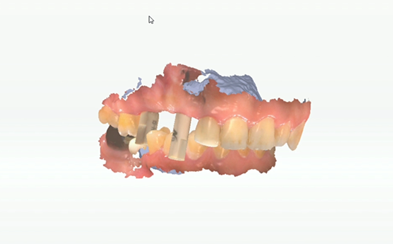 Fig. 4 - Scan bite