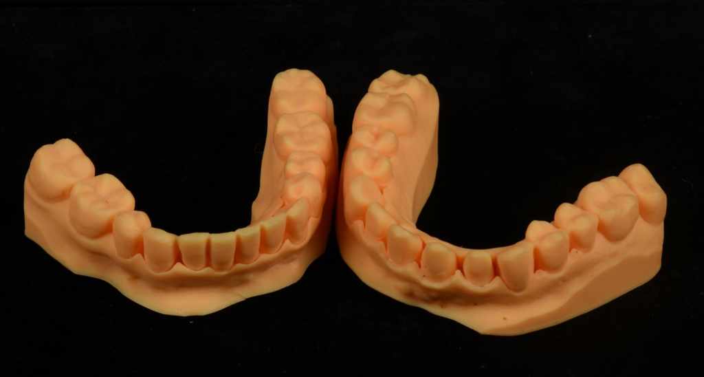 The dental model printed by AccuFab-L4D