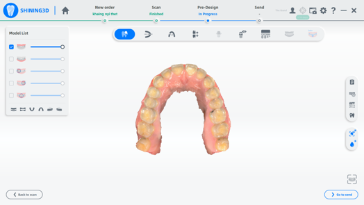 the intraoral data from Aoralscan 3