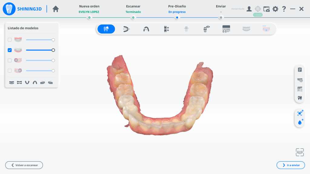 The intraoral data is captured by Aoralscan 3