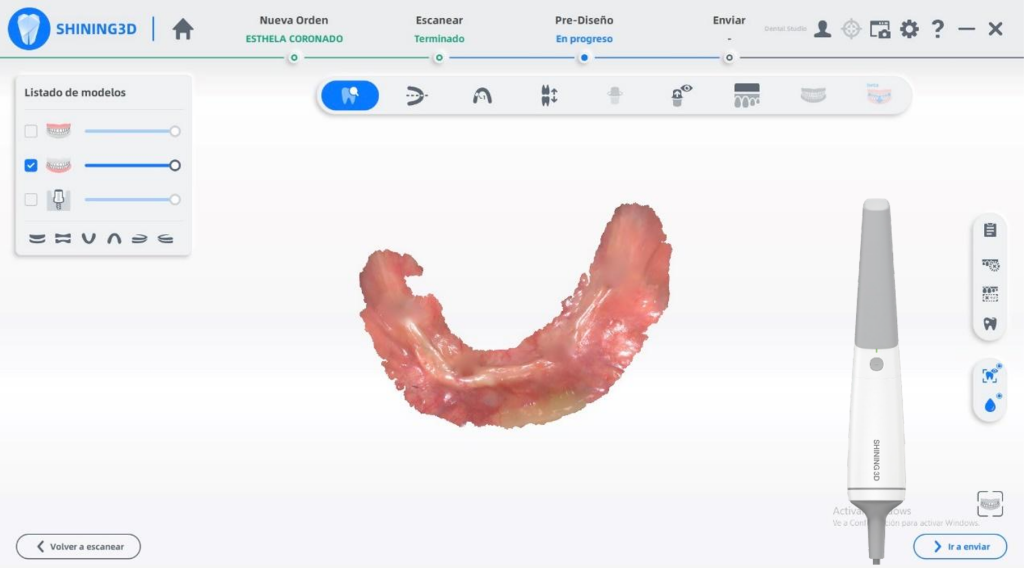 lower jaw data scanned by Aoralscan 3