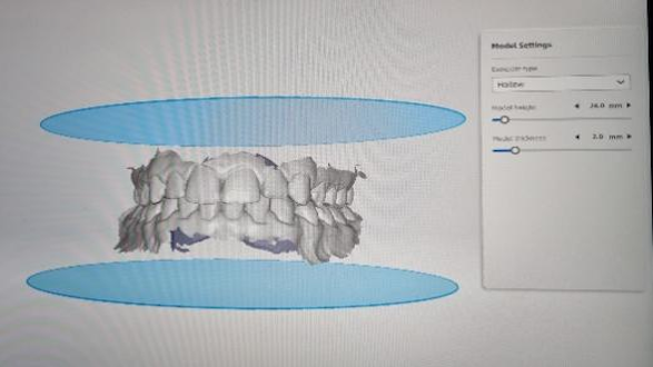 Modelling by AccuDesign