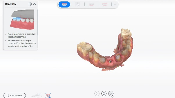 Intraoral scan data from Aoralscan 3