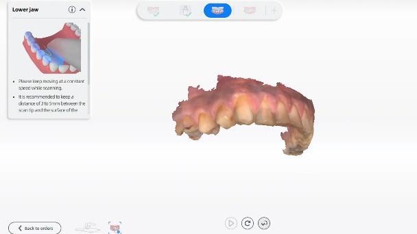 Intraoral scan data from Aoralscan 3