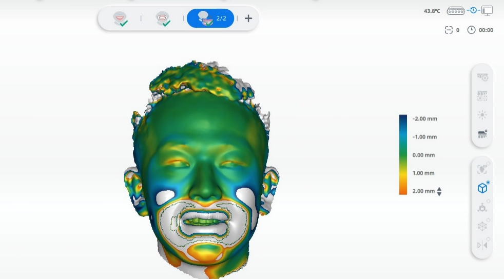 MetiSmile aligns the extracted facial data and smile facial data