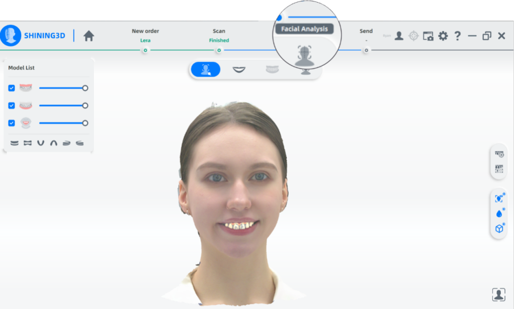 The face analysis module is integrated into FScan software