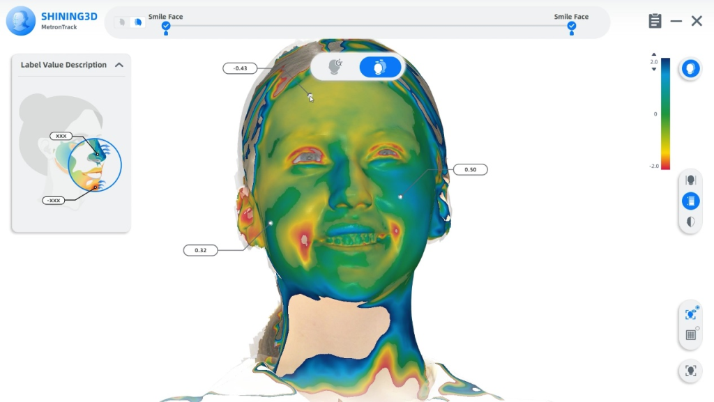 The comparison between before and after treatment is appeared in face analysis module