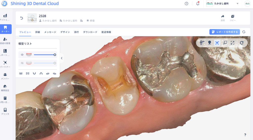 保険収載を機にIOS導入を考える - www.shining3ddental.com
