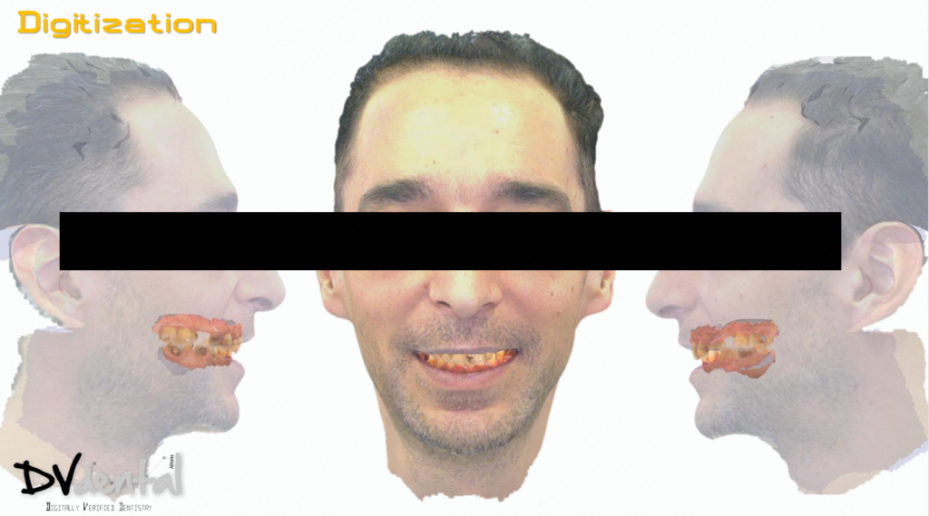 Face scan data before treatment