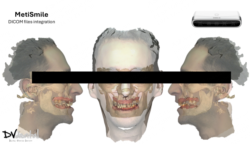 The MetiSmile CBCT data