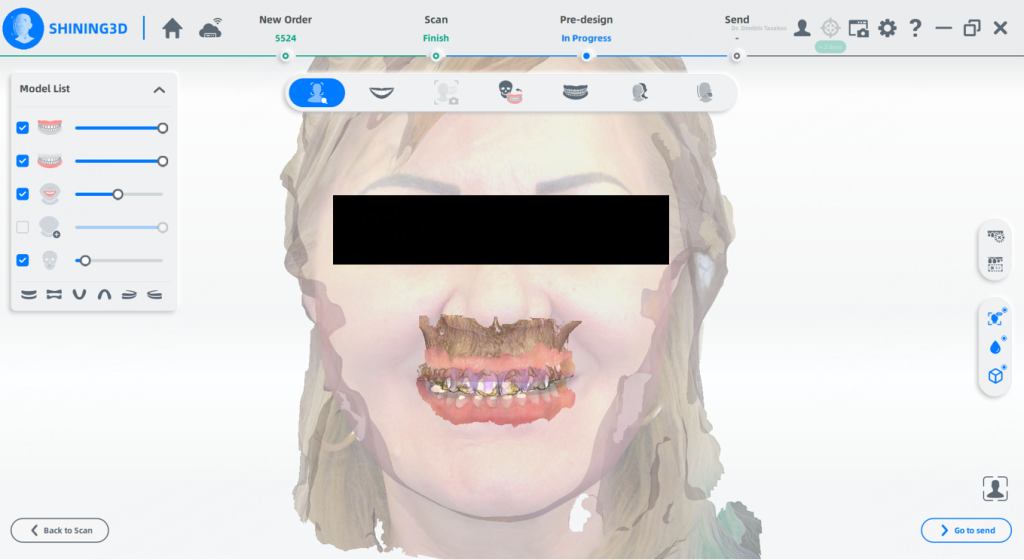 intraoral scan data
