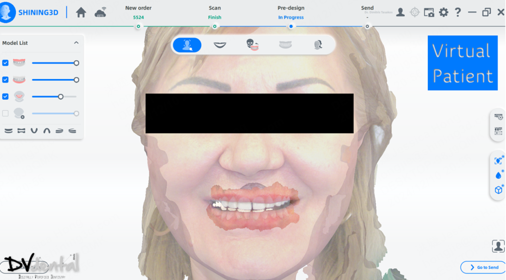 The face scan data captured by MetiSmile
