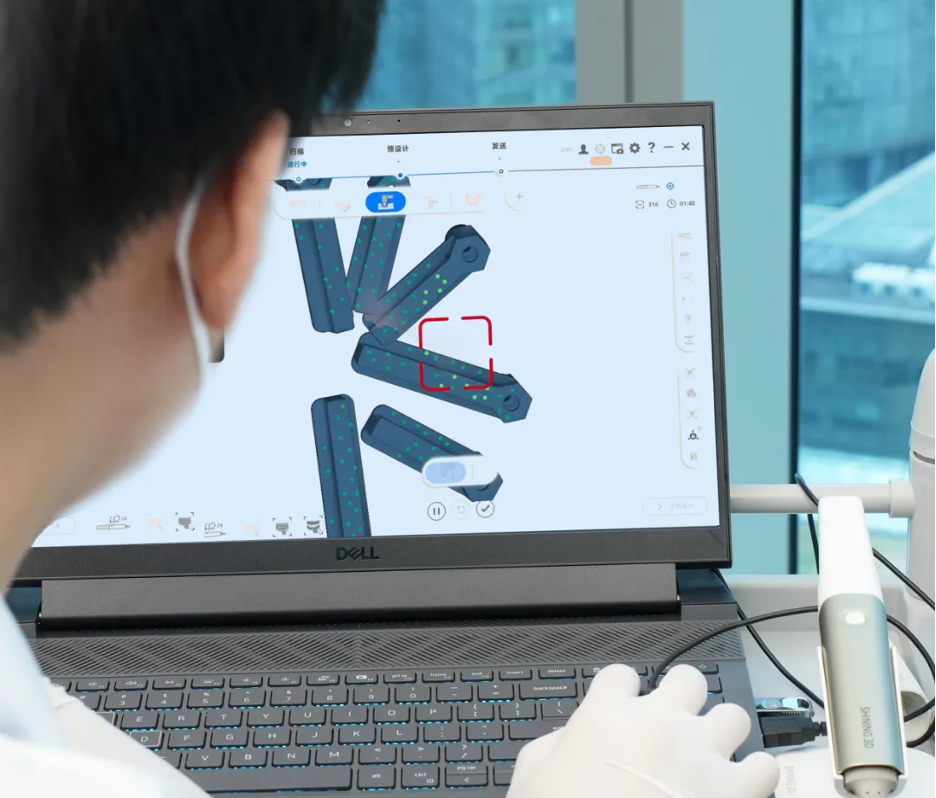 digital teeth impressions