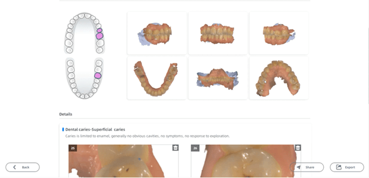 3d oral scanner