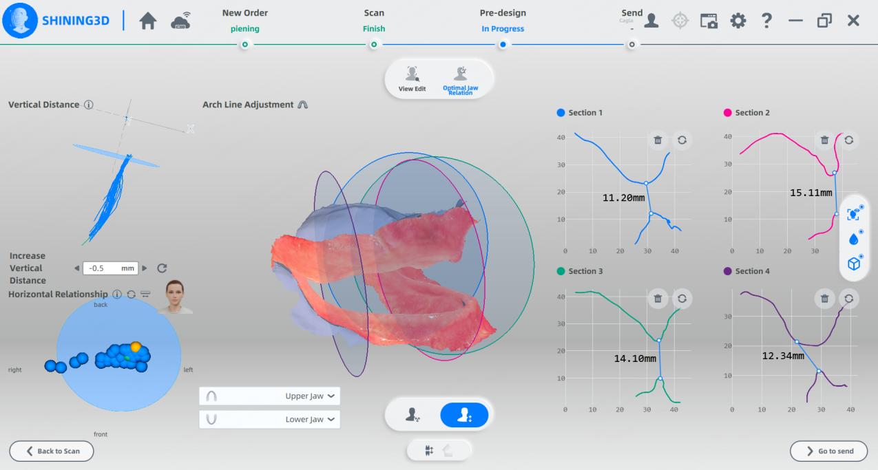 Shining 3D Digital Workflow for Dentures Using Aoralscan Elite and ...